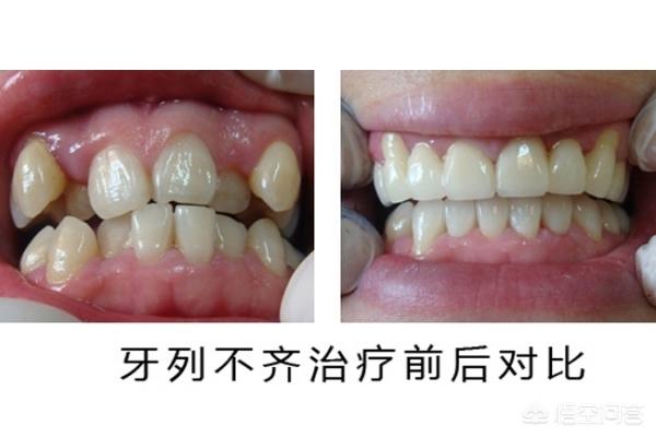 固安最新24小时牙医在线咨询方法分析(最方便真实的固安有没有24小时牙医方法)