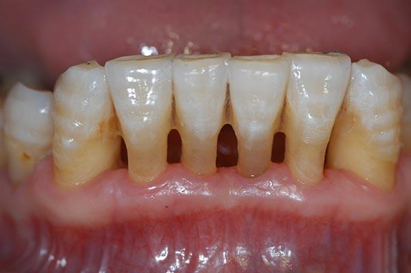 固安最新24小时牙医在线咨询方法分析(最方便真实的固安有没有24小时牙医方法)